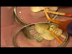 SANI トリートメントケース